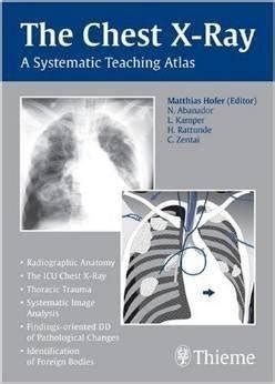 the chest x ray a systematic teaching atlas Doc